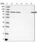 TBC1 Domain Family Member 5 antibody, HPA035125, Atlas Antibodies, Western Blot image 