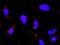 SRC Proto-Oncogene, Non-Receptor Tyrosine Kinase antibody, H00006714-M01, Novus Biologicals, Proximity Ligation Assay image 