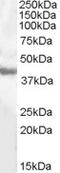 Glutamic-Oxaloacetic Transaminase 1 antibody, TA303294, Origene, Western Blot image 