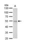 Fli-1 Proto-Oncogene, ETS Transcription Factor antibody, NBP2-16500, Novus Biologicals, Western Blot image 