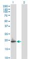 ADP Ribosylation Factor 5 antibody, MA5-18416, Invitrogen Antibodies, Western Blot image 