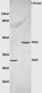 Ceramide Synthase 2 antibody, GTX51624, GeneTex, Western Blot image 
