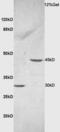 Ceramide Synthase 2 antibody, GTX51624, GeneTex, Western Blot image 