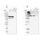 THO Complex 1 antibody, NBP1-89670, Novus Biologicals, Western Blot image 