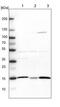 ATP Synthase F1 Subunit Delta antibody, NBP1-86162, Novus Biologicals, Western Blot image 