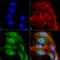 Voltage Dependent Anion Channel 1 antibody, LS-C773580, Lifespan Biosciences, Immunocytochemistry image 