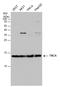 Tubulin-specific chaperone A antibody, GTX130832, GeneTex, Western Blot image 