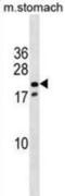 NK3 Homeobox 1 antibody, abx030932, Abbexa, Western Blot image 