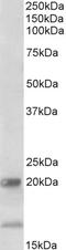 Interleukin-17B antibody, LS-C186527, Lifespan Biosciences, Western Blot image 