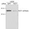 hPot1 antibody, TA353394L, Origene, Western Blot image 