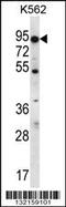 ATP Binding Cassette Subfamily D Member 2 antibody, 56-546, ProSci, Western Blot image 