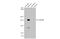 Collagen Type I Alpha 1 Chain antibody, GTX112731, GeneTex, Western Blot image 