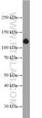 Collagen Type I Alpha 2 Chain antibody, 14695-1-AP, Proteintech Group, Western Blot image 