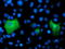 Proteasome 26S Subunit, Non-ATPase 2 antibody, TA503219, Origene, Immunofluorescence image 