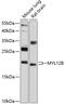Myosin Light Chain 12B antibody, 19-533, ProSci, Western Blot image 