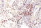 MAGE Family Member A1 antibody, AM32863PU-S, Origene, Immunohistochemistry frozen image 