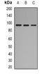 Complement C7 antibody, orb339113, Biorbyt, Western Blot image 