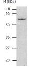 Pyruvate Kinase M1/2 antibody, TA322979, Origene, Western Blot image 
