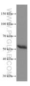 Immunoglobulin Heavy Constant Gamma 4 (G4m Marker) antibody, 66408-1-Ig, Proteintech Group, Western Blot image 