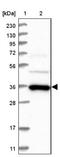 Synaptonemal Complex Protein 2 Like antibody, NBP1-91163, Novus Biologicals, Western Blot image 