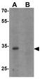 Chromobox 4 antibody, GTX31493, GeneTex, Western Blot image 