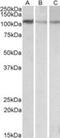 Methylenetetrahydrofolate Dehydrogenase (NADP+ Dependent) 1 Like antibody, NBP1-78279, Novus Biologicals, Western Blot image 
