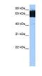 Tetratricopeptide Repeat Domain 12 antibody, NBP1-56424, Novus Biologicals, Western Blot image 