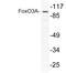 Forkhead Box O3 antibody, LS-C177630, Lifespan Biosciences, Western Blot image 