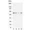 Matrix Metallopeptidase 10 antibody, R30451, NSJ Bioreagents, Western Blot image 