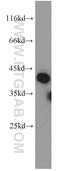Regulating Synaptic Membrane Exocytosis 3 antibody, 15088-1-AP, Proteintech Group, Western Blot image 