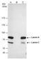 Lamin A/C antibody, GTX101127, GeneTex, Immunoprecipitation image 