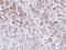Exostosin Like Glycosyltransferase 3 antibody, GTX101931, GeneTex, Immunohistochemistry paraffin image 