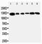 Telomerase Reverse Transcriptase antibody, PA1696, Boster Biological Technology, Western Blot image 