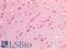Platelet Derived Growth Factor Receptor Alpha antibody, LS-A10888, Lifespan Biosciences, Immunohistochemistry paraffin image 