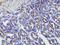 Matrix Metallopeptidase 16 antibody, PA1123, Boster Biological Technology, Immunohistochemistry frozen image 