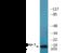 Stathmin 1 antibody, EKC2521, Boster Biological Technology, Western Blot image 