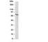 Estrogen Receptor 2 antibody, R30294, NSJ Bioreagents, Western Blot image 