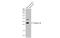 Chymotrypsin Like Elastase 3B antibody, GTX115702, GeneTex, Western Blot image 