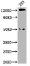 Cadherin 1 antibody, CSB-PA005034MA01HU, Cusabio, Western Blot image 