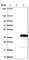 Pleckstrin Homology And FYVE Domain Containing 2 antibody, HPA024829, Atlas Antibodies, Western Blot image 