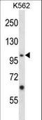 EPH Receptor A4 antibody, LS-C164375, Lifespan Biosciences, Western Blot image 