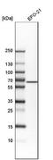 Activin A Receptor Like Type 1 antibody, NBP1-90254, Novus Biologicals, Western Blot image 