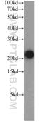 Transmembrane Protein 11 antibody, 16564-1-AP, Proteintech Group, Western Blot image 