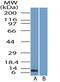 Pancreatic secretory trypsin inhibitor antibody, NBP2-29620, Novus Biologicals, Western Blot image 