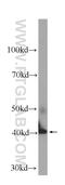 Glutamic-Oxaloacetic Transaminase 1 antibody, 60317-1-Ig, Proteintech Group, Western Blot image 