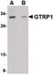 Growth Hormone Regulated TBC Protein 1 antibody, PA5-20567, Invitrogen Antibodies, Western Blot image 