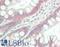 Syndecan 1 antibody, LS-B14224, Lifespan Biosciences, Immunohistochemistry paraffin image 