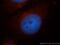 Collagen Type III Alpha 1 Chain antibody, 13548-1-AP, Proteintech Group, Immunofluorescence image 