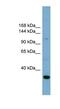 Solute Carrier Family 9 Member A1 antibody, NBP1-62408, Novus Biologicals, Western Blot image 