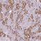 MAX Dimerization Protein MLX antibody, FNab05222, FineTest, Immunohistochemistry paraffin image 